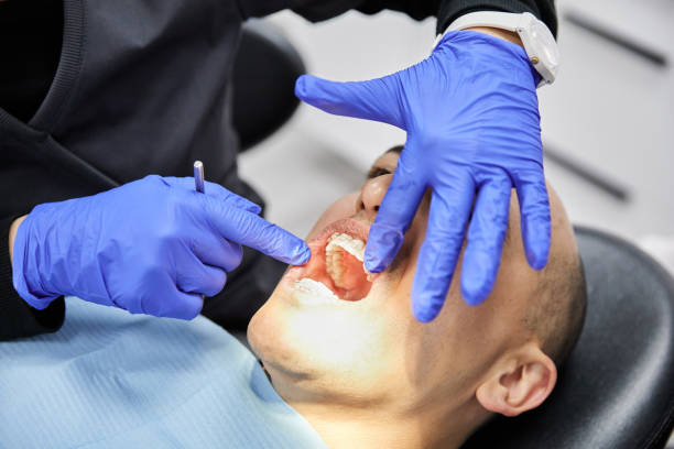Best Dental Abscess Treatment in San Joaquin, CA
